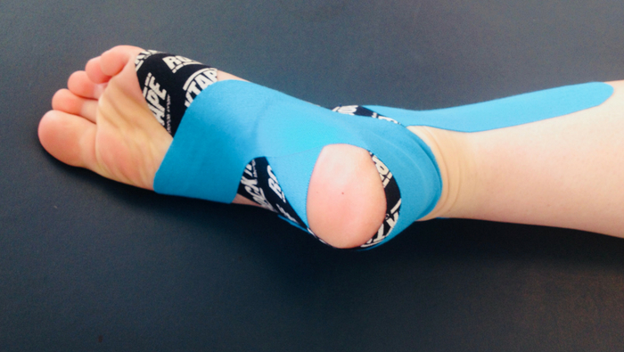 Are you getting pain in the sole of your foot?